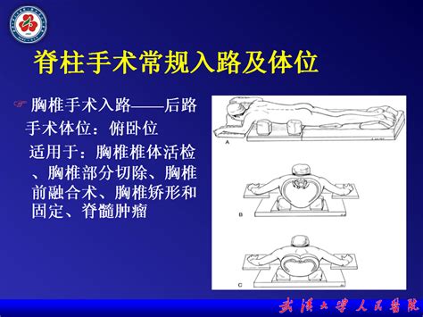 背面側位|侧入体位